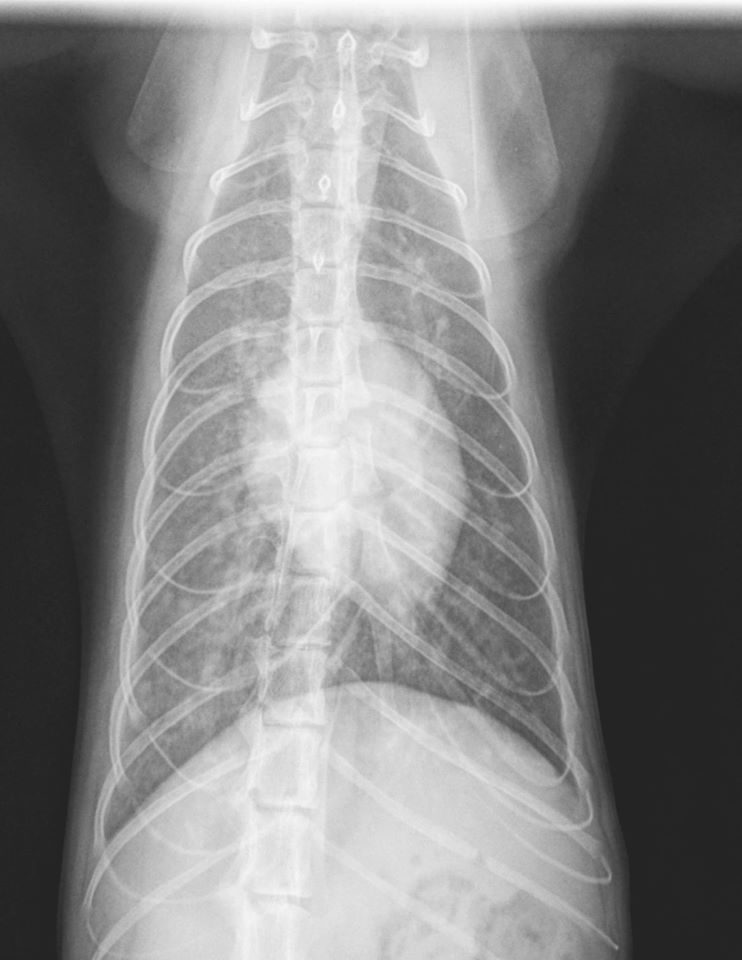 Chest X-ray showing ribs and spine.